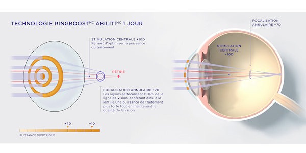 Lancement de la gamme Acuvue Abiliti : l’interview !