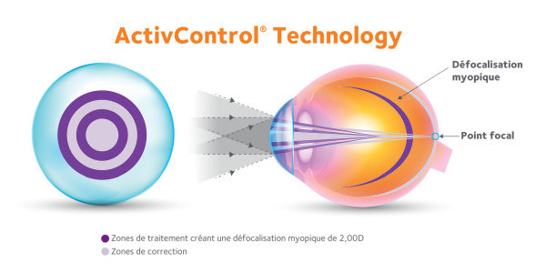 Congrès SFO : Lancement réussi de MyDay® MiSight® 1 day, la nouvelle lentille de freination de la myopie de CooperVision